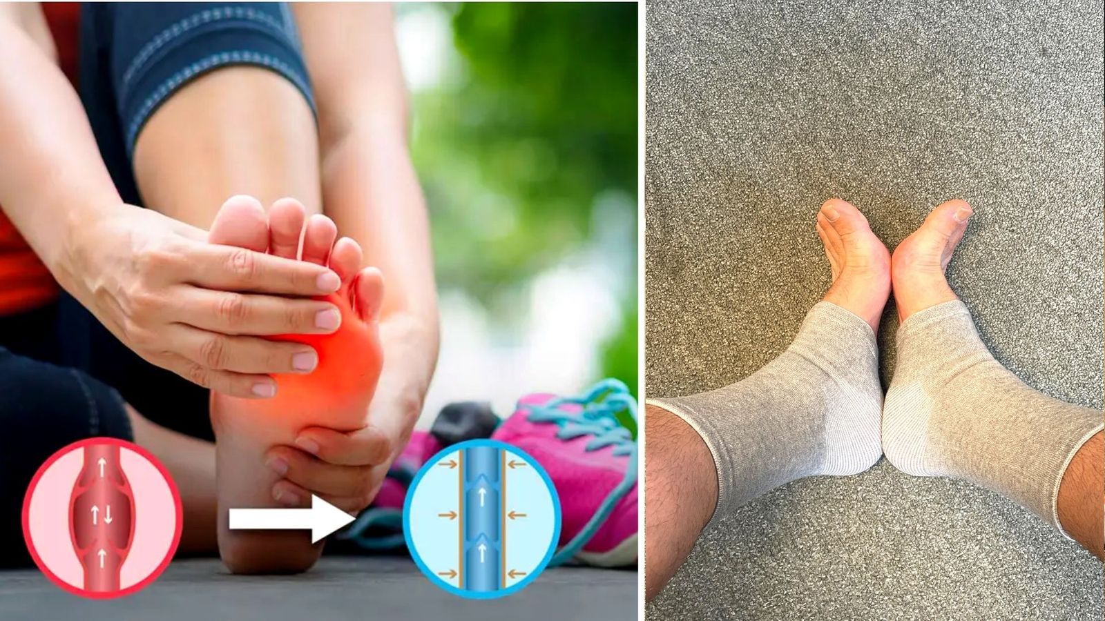 Kompressionsstrumpor - Bli kvitt smärtan!